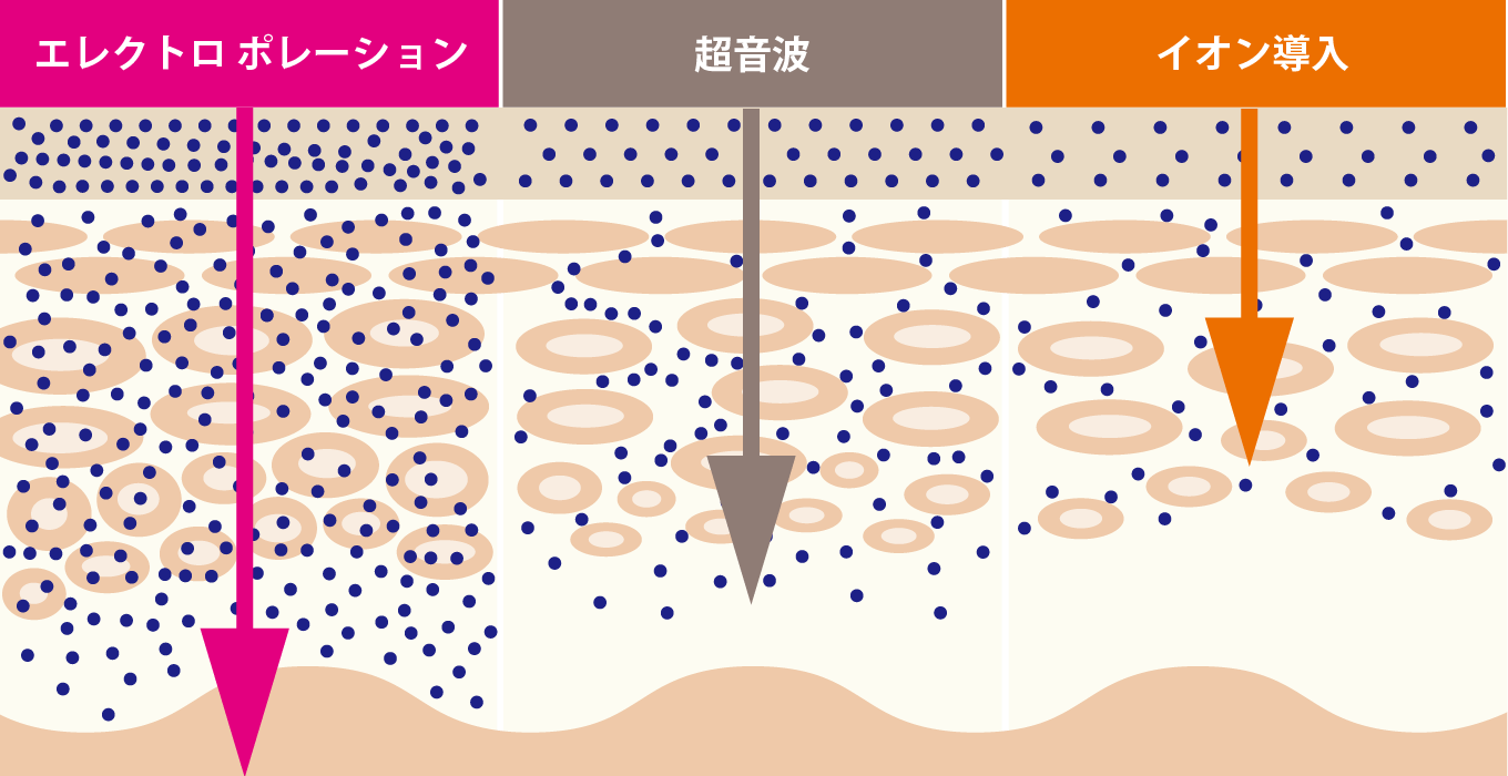 リフトアップのポイント